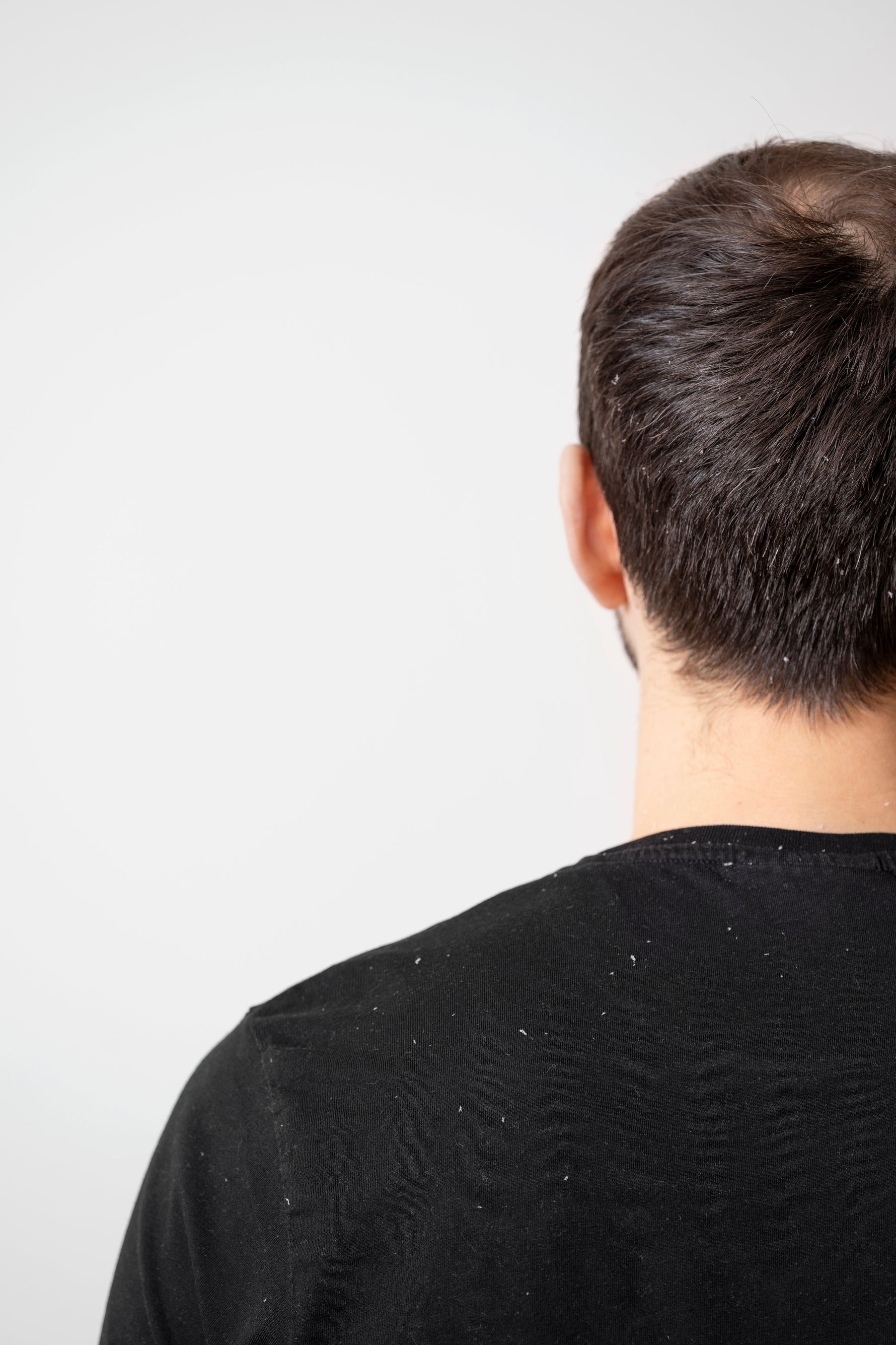 Dandruff & Itchy Scalp Relief: Gentle & Effective Solutions