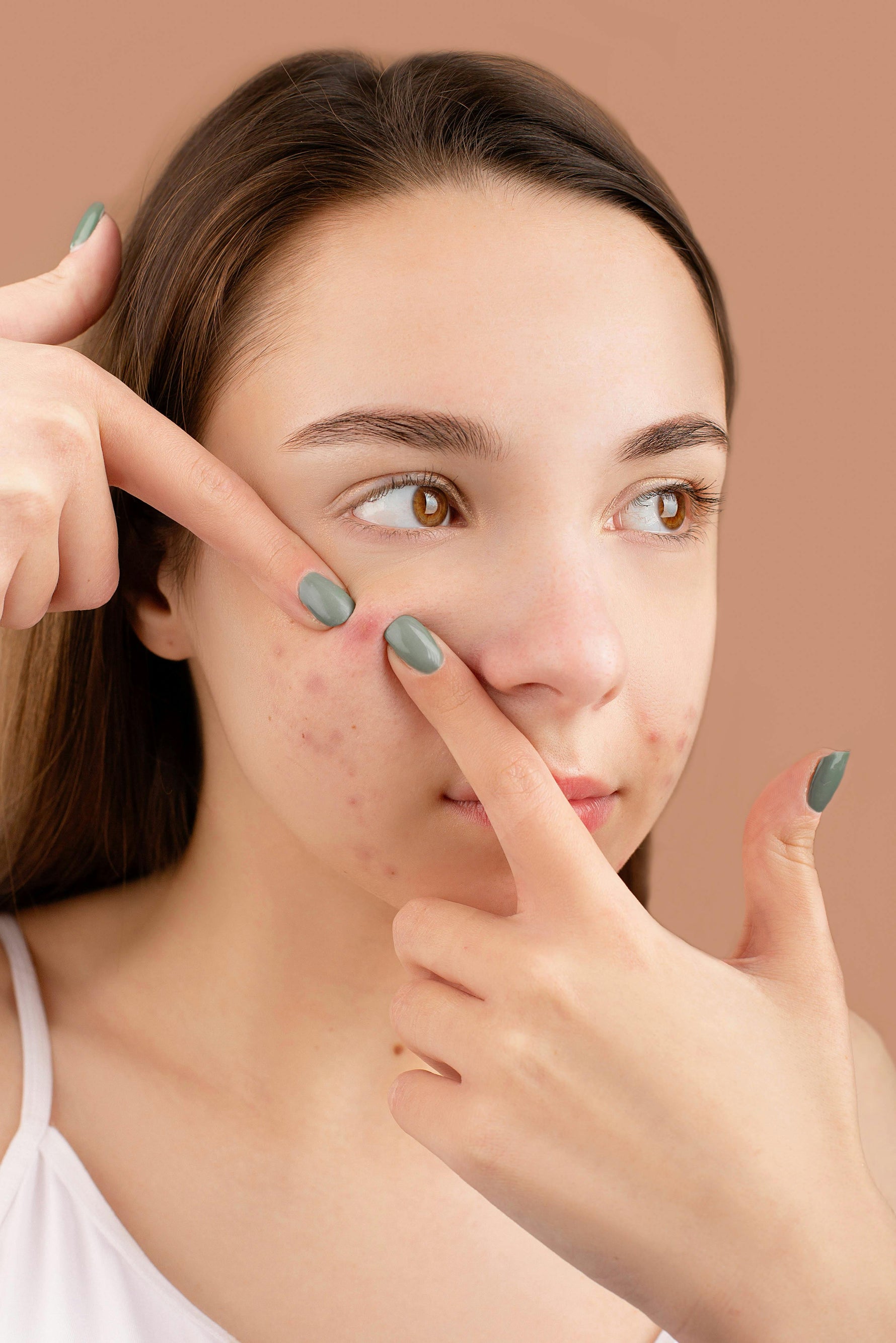 Teen Acne: Supporting Clearer Skin Without the Harsh Chemicals